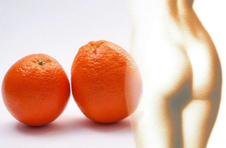 Lieber Orangenhaut, als gar kein Profil -Spuren der Coronakrise